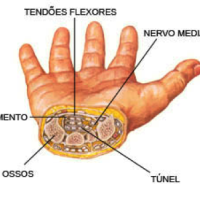 Tratamento: Síndrome do Túnel do Carpo